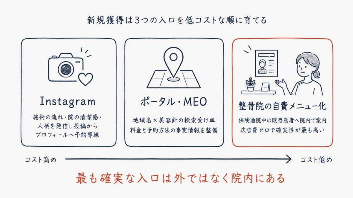 美容鍼の新規獲得の3つの入口 — Instagram・ポータル・MEO・整骨院の自費メニュー化